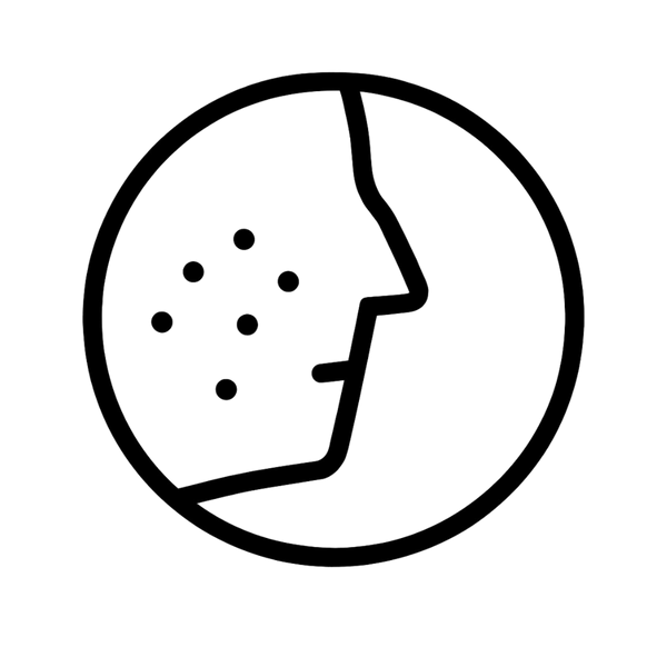 Bestrijdt acne-bacteriën effectief